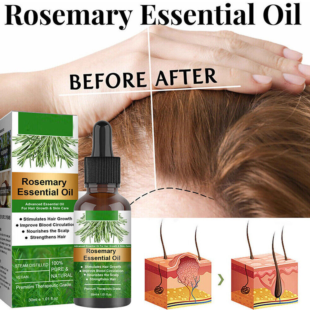 US 2-4 Pcs Rosemary Essential Oil Hair Growth 100% Pure Natural Therapeutic