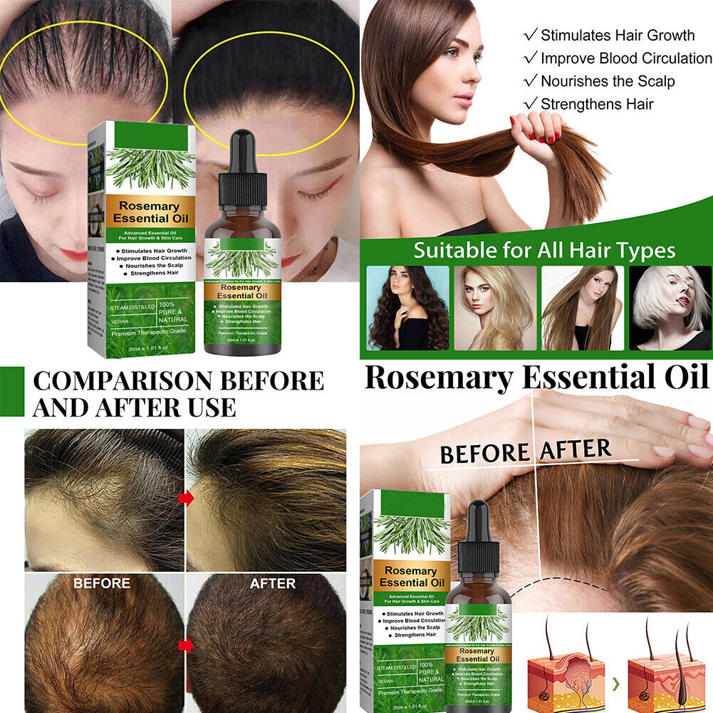 US 2-4 Pcs Rosemary Essential Oil Hair Growth 100% Pure Natural Therapeutic