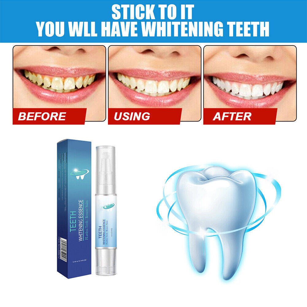 US 1-2 Pack Teeth Whitening Essence Pen Intensive Stain Remover Reduce Yellowing