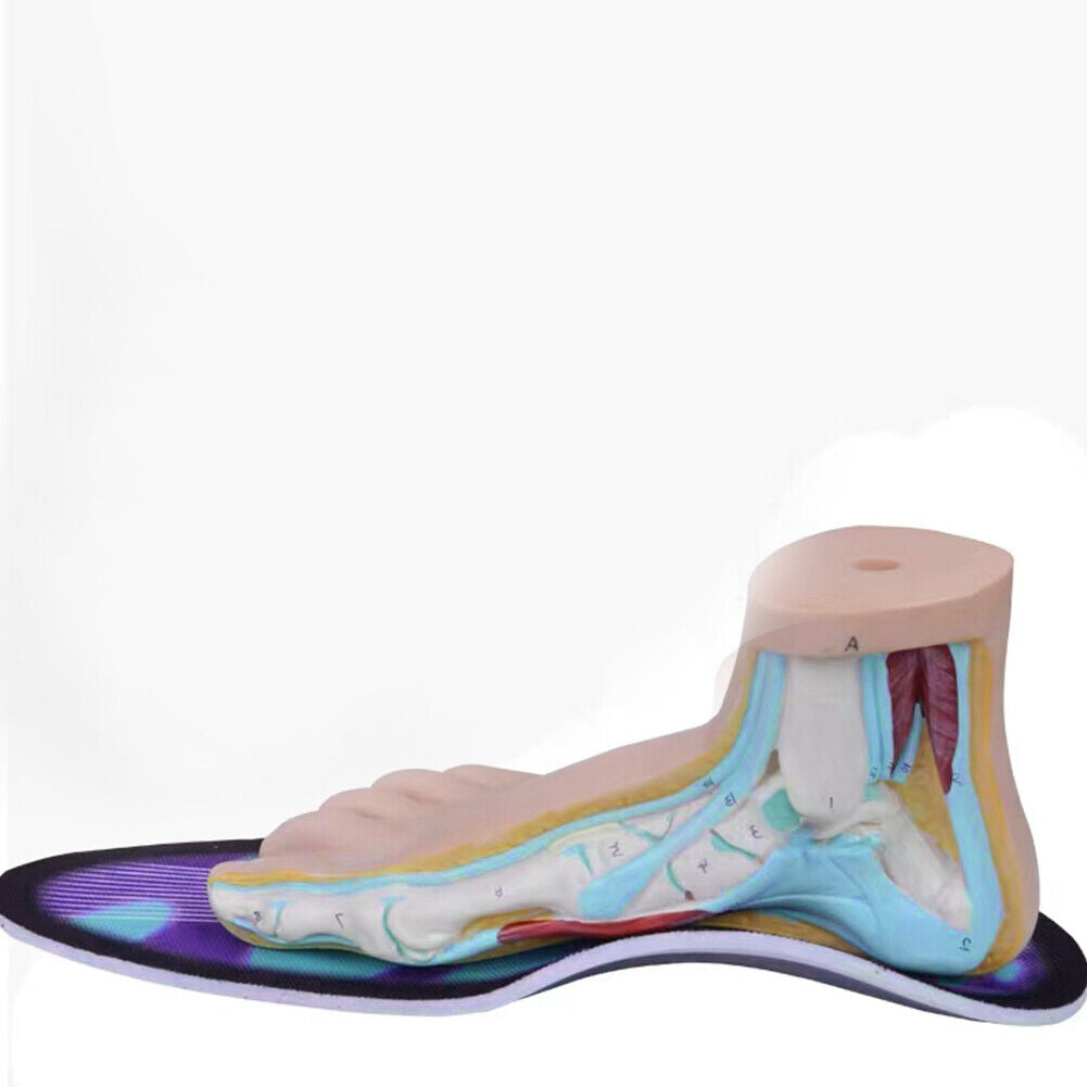 US 1-2Paris Orthotic Shoe Insole Arch Support Insert Flat Feet Plantar Fasciitis