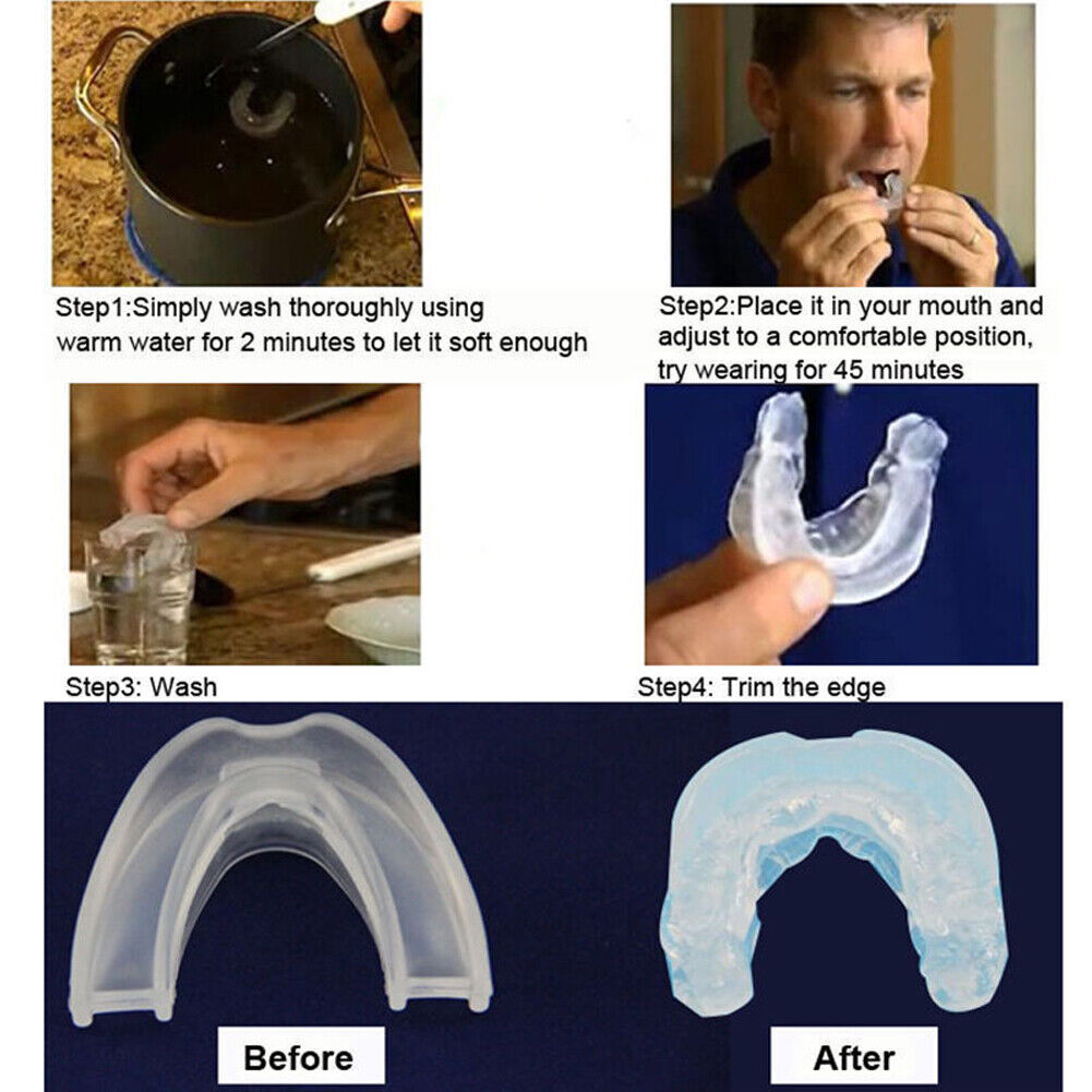 US 2-4 Pc Anti-Snoring Mouthpiece Mouth Guard Grind Stop Sleep Apnea Bruxism Aid