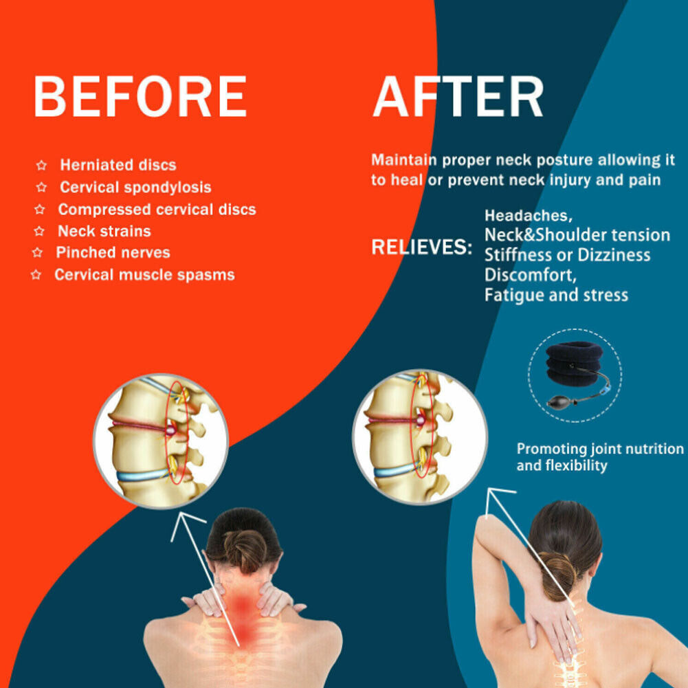 US 1-2 Pcs Cervical Neck Traction Device Instant Neck Pain Relief Brace Therapy