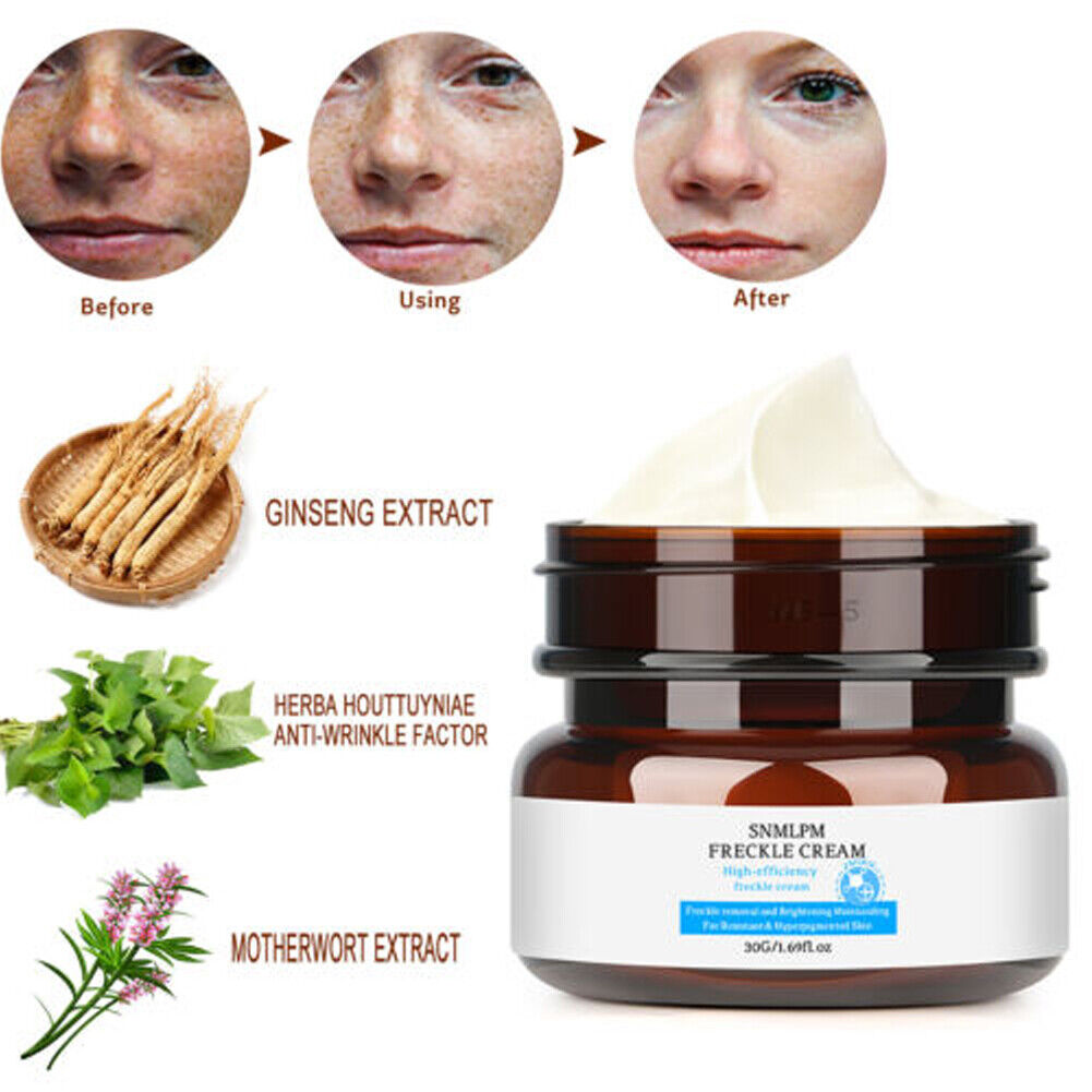 US 1-2 Pcs Whitening Freckle Cream Dark Spot Melasma Moisturize Lotion Corrector