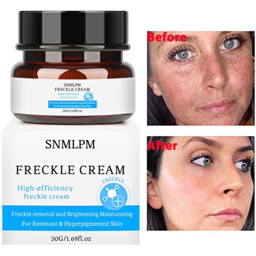 US 1-2 Pcs Whitening Freckle Cream Dark Spot Melasma Moisturize Lotion Corrector