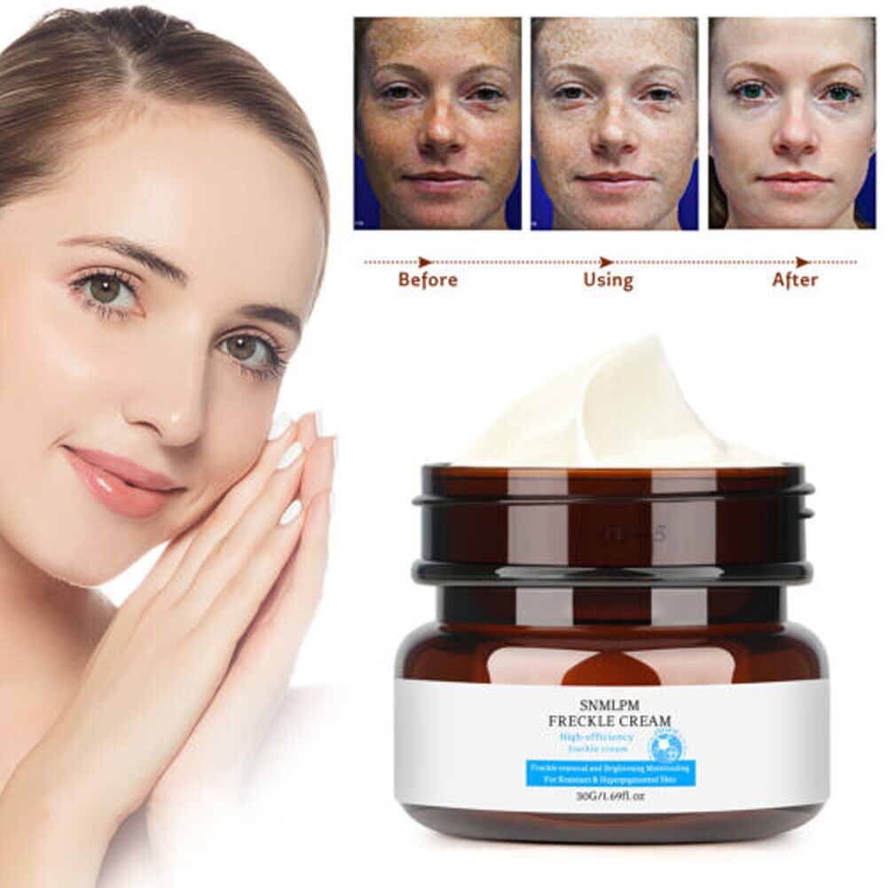 US 1-2 Pcs Whitening Freckle Cream Dark Spot Melasma Moisturize Lotion Corrector