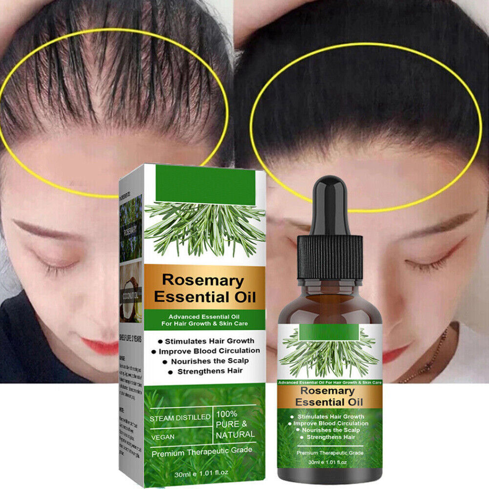 US 2-4 Pcs Rosemary Essential Oil Hair Growth 100% Pure Natural Therapeutic