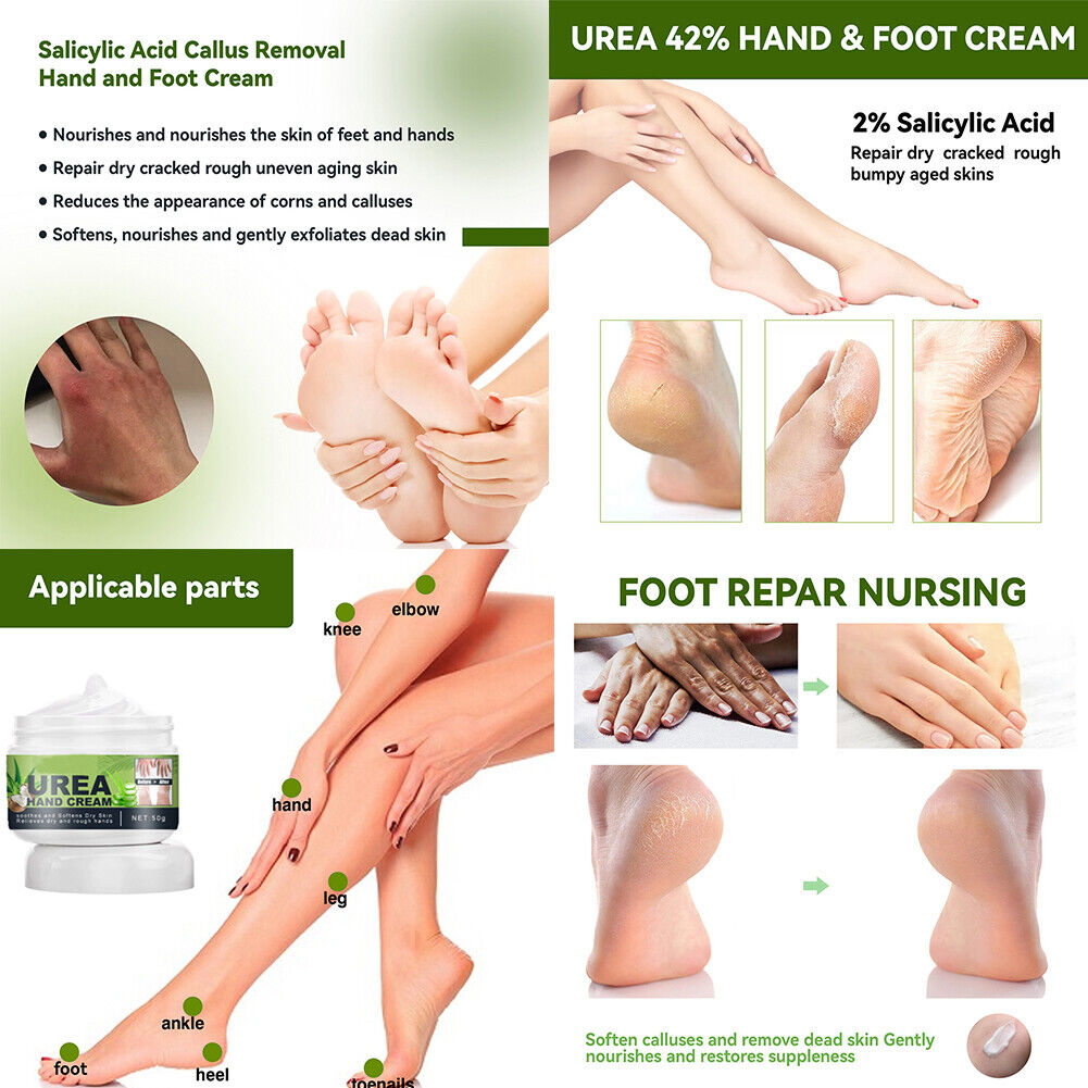 US 1-2 Pc Hand Cream 42%Urea Salicylic Acid Deep Moisturizing Softening Skin