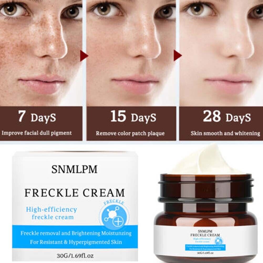 US 1-2 Pcs Whitening Freckle Cream Dark Spot Melasma Moisturize Lotion Corrector