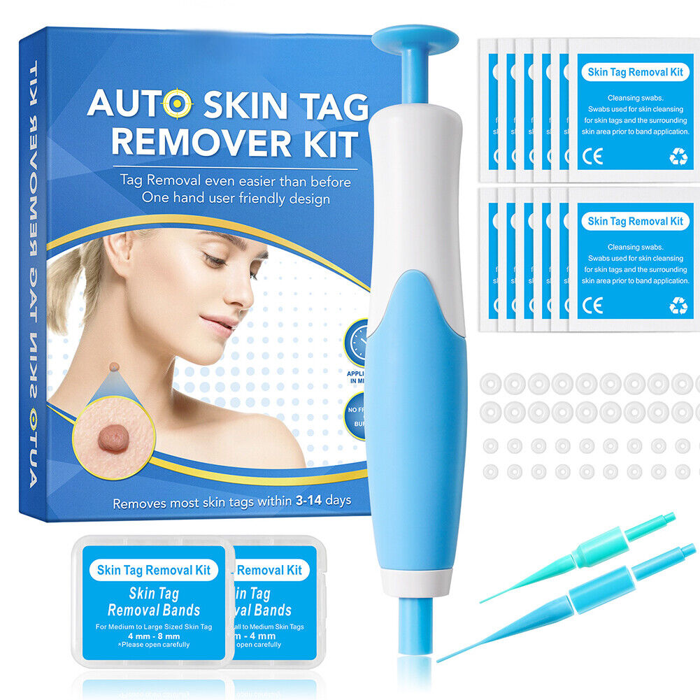 US 1-2 Pcs Auto Micro Skin Tag Remover Device Kit Safe Painless Removal Set Tool