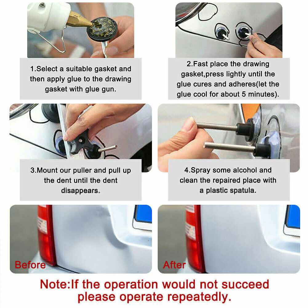 US 1~2 Pack Auto Car Dent Body Damage Repair Hail Removal Kit Bridge Lifter Tool