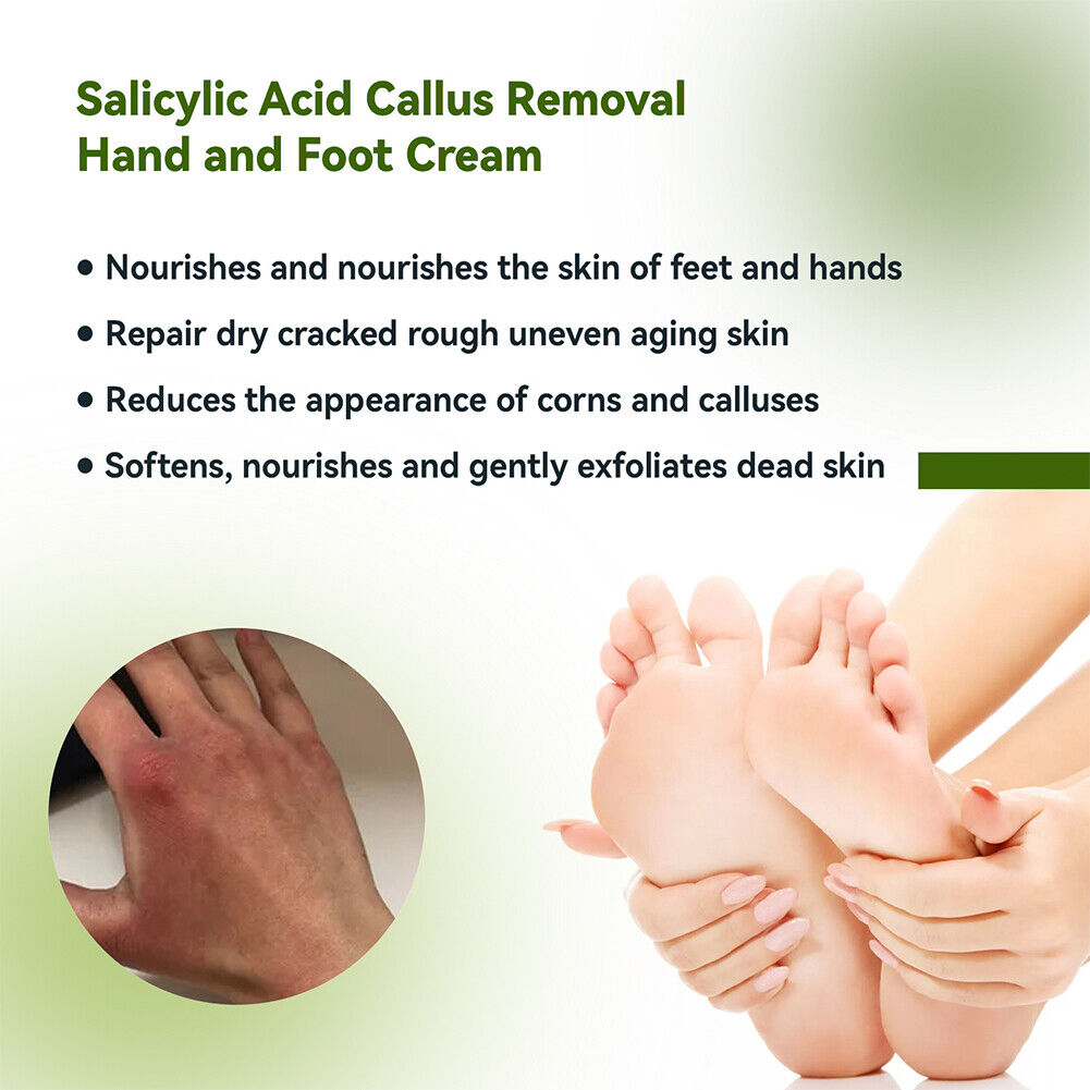 US 1-2 Pc Hand Cream 42%Urea Salicylic Acid Deep Moisturizing Softening Skin