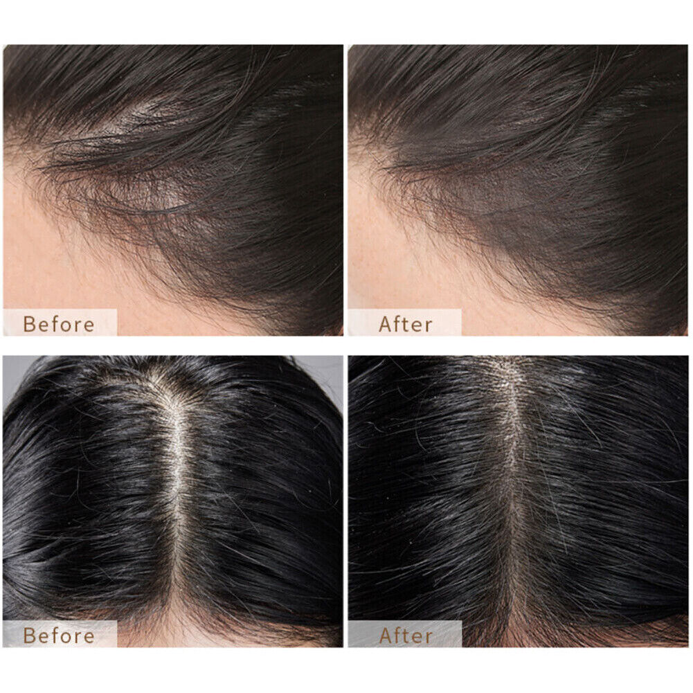 US 1-2 Pack Hairline Powder Concealer Instantly Hair Line Shadow Cover Hair Root