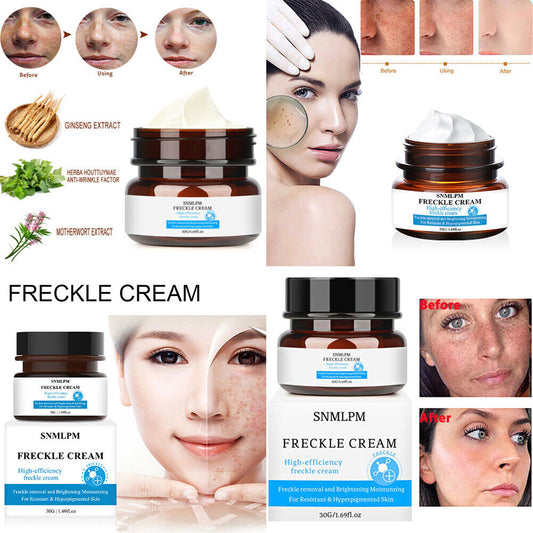 US 1-2 Pcs Whitening Freckle Cream Dark Spot Melasma Moisturize Lotion Corrector