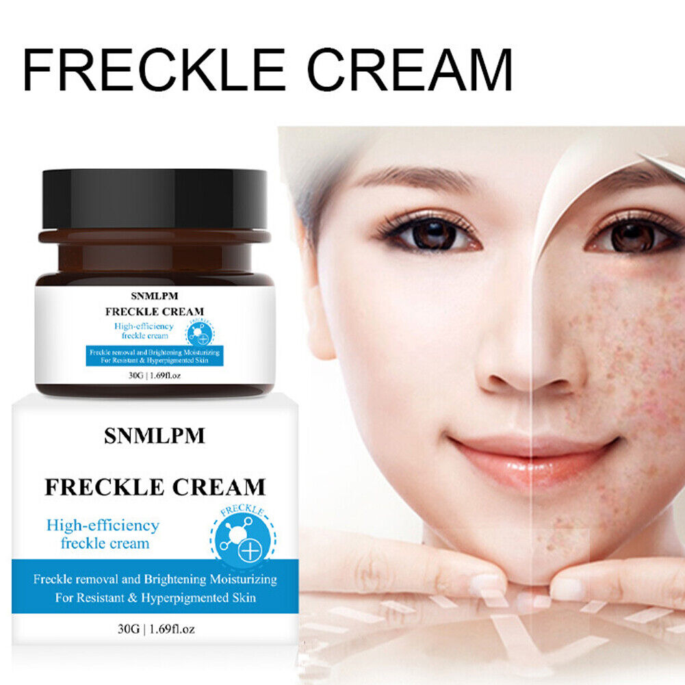 US 1-2 Pcs Whitening Freckle Cream Dark Spot Melasma Moisturize Lotion Corrector