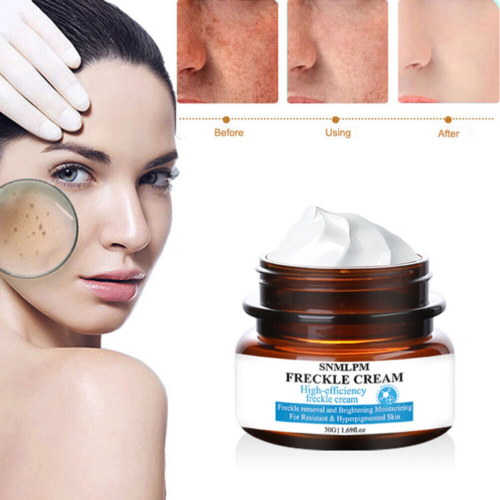 US 1-2 Pcs Whitening Freckle Cream Dark Spot Melasma Moisturize Lotion Corrector