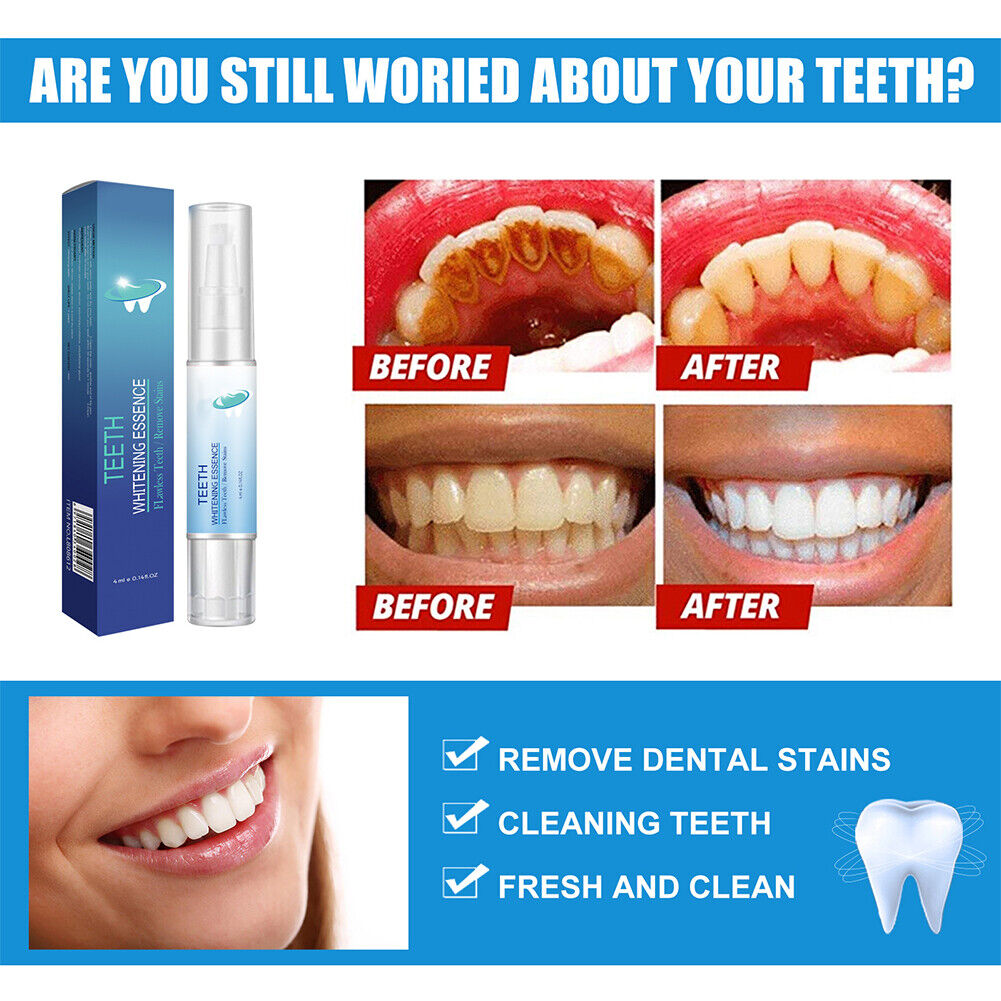 US 1-2 Pack Teeth Whitening Essence Pen Intensive Stain Remover Reduce Yellowing