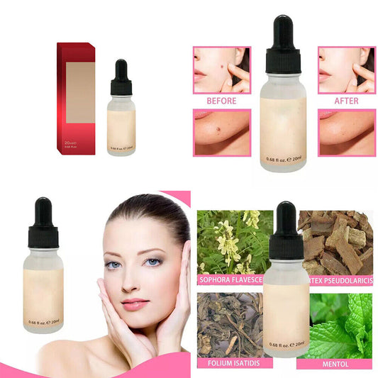 US 2-4 Pcs Serum Mole Skin Tag Dark Spots Warts Remover Serum Dark Spot Remover
