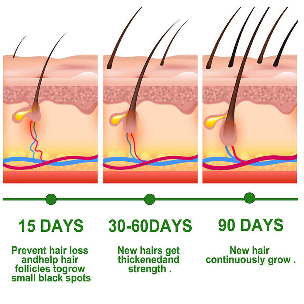 US 2-4 Pcs Rosemary Essential Oil Hair Growth 100% Pure Natural Therapeutic